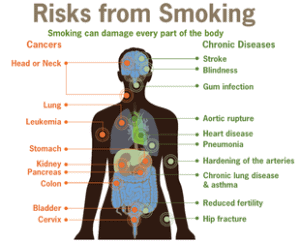 Benefits of Smoking - Emergency Drug - Information About Health Benefits